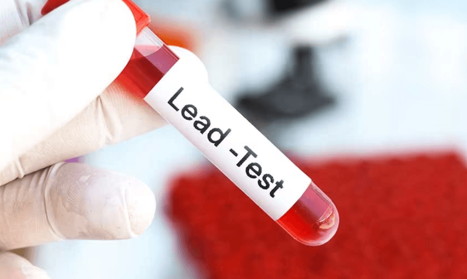 Blood Lead Test Significance
